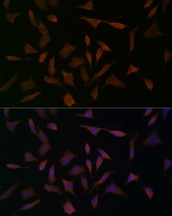 Invitrogen BCAT1 Polyclonal Antibody 100 &mu;L; Unconjugated:Antibodies,