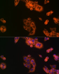 Invitrogen BCAT1 Polyclonal Antibody 100 &mu;L; Unconjugated:Antibodies,