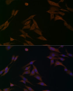 Invitrogen BCAT1 Polyclonal Antibody 100 &mu;L; Unconjugated:Antibodies,