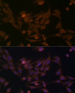 Invitrogen BCAT1 Polyclonal Antibody 100 &mu;L; Unconjugated:Antibodies,