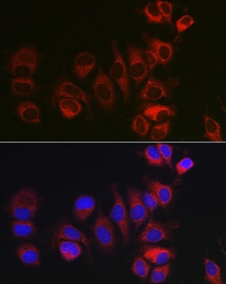 Invitrogen BOK Polyclonal Antibody 100 μL; Unconjugated:Antibodies,