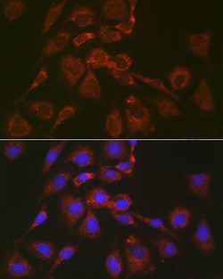 Invitrogen BOK Polyclonal Antibody 100 μL; Unconjugated:Antibodies,