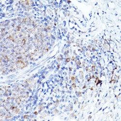Invitrogen BOK Polyclonal Antibody 100 μL; Unconjugated:Antibodies,