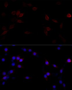 Invitrogen Filamin A Polyclonal Antibody 100 &mu;L; Unconjugated:Antikörper