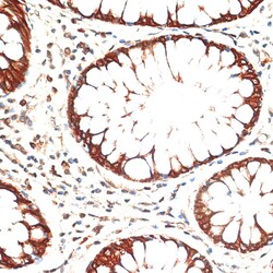 Invitrogen Cytokeratin 13 Polyclonal Antibody 100 &mu;L; Unconjugated:Anticuerpos