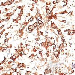 Invitrogen Cytokeratin 13 Polyclonal Antibody 100 &mu;L; Unconjugated:Anticuerpos