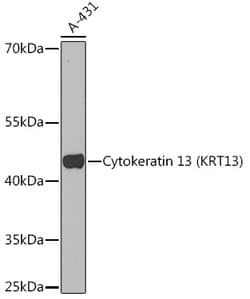 Invitrogen Cytokeratin 13 Polyclonal Antibody 100 &mu;L; Unconjugated:Anticuerpos