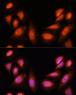 Invitrogen SPT6 Polyclonal Antibody 100 &mu;L; Unconjugated:Antibodies,