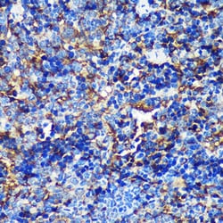Invitrogen CAND2 Polyclonal Antibody 100 &mu;L; Unconjugated:Antibodies,