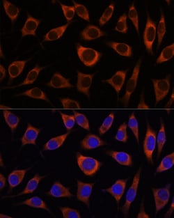 Invitrogen CTNNA3 Polyclonal Antibody 100 &mu;L | Buy Online | Invitrogen&trade; | Fisher Scientific