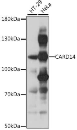 Invitrogen CARD14 Polyclonal Antibody 100 &mu;L; Unconjugated:Antibodies,