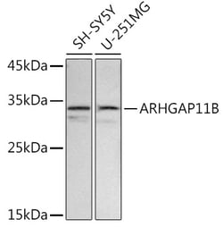 Invitrogen ARHGAP11B Polyclonal Antibody 100 &mu;L; Unconjugated:Antibodies,