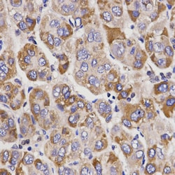 Invitrogen UGT1A9 Polyclonal Antibody 100 &mu;L; Unconjugated:Antibodies,