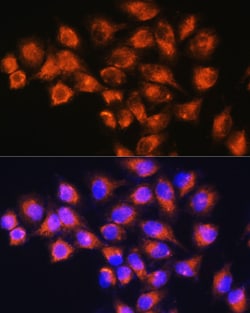 Invitrogen Neuropeptide B Polyclonal Antibody 100 &mu;L; Unconjugated:Antibodies,
