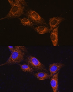 Invitrogen Neuropeptide B Polyclonal Antibody 100 &mu;L; Unconjugated:Antibodies,