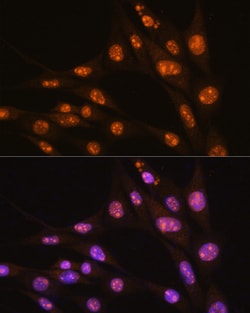 Invitrogen YY2 Polyclonal Antibody 100 μL; Unconjugated:Antibodies,