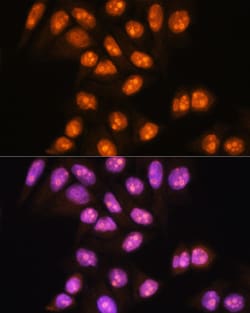 Invitrogen YY2 Polyclonal Antibody 100 μL; Unconjugated:Antibodies,
