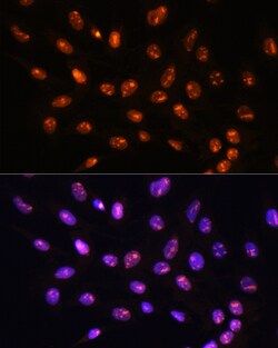 Invitrogen YY2 Polyclonal Antibody 100 μL; Unconjugated:Antibodies,