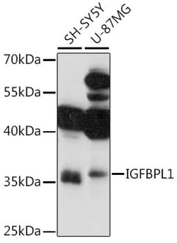 Invitrogen IGFBPL1 Polyclonal Antibody 100 &mu;L | Buy Online | Invitrogen&trade; | Fisher Scientific