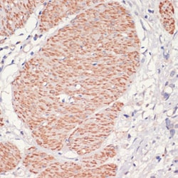 Invitrogen AMPK alpha-1 Polyclonal Antibody 100 &mu;L; Unconjugated:Antibodies,