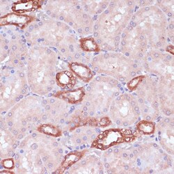 Invitrogen UGT2B15 Polyclonal Antibody 100 &mu;L; Unconjugated:Antibodies,