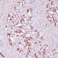 Invitrogen UGT2B15 Polyclonal Antibody 100 &mu;L; Unconjugated:Antibodies,