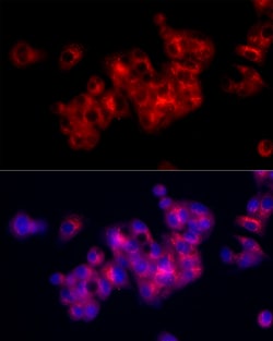 Invitrogen Fibronectin Polyclonal Antibody 100 &mu;L; Unconjugated:Antibodies,
