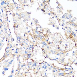 Invitrogen Fibronectin Polyclonal Antibody 100 &mu;L; Unconjugated:Antibodies,