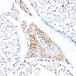 Invitrogen Fibronectin Polyclonal Antibody 100 &mu;L; Unconjugated:Antibodies,
