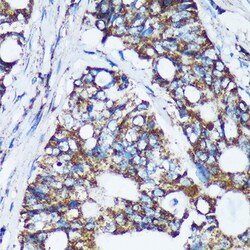 Invitrogen NKIAMRE Polyclonal Antibody 100 &mu;L; Unconjugated:Antibodies,