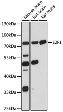 Invitrogen E2F1 Polyclonal Antibody 100 μL; Unconjugated:Antibodies,