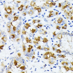 Invitrogen AMOTL2 Polyclonal Antibody 100 &mu;L; Unconjugated:Antibodies,