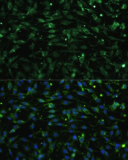 Invitrogen CHRM1 Polyclonal Antibody 100 &mu;L; Unconjugated:Antibodies,