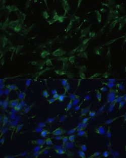 Invitrogen CHRM1 Polyclonal Antibody 100 &mu;L; Unconjugated:Antibodies,