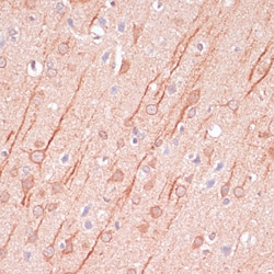 Invitrogen SAP102 Polyclonal Antibody 100 &mu;L; Unconjugated:Antibodies,