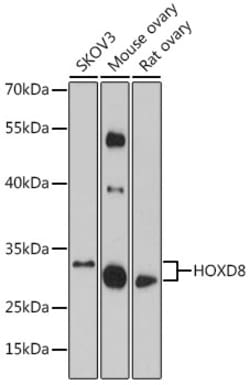 Invitrogen HOXD8 Polyclonal Antibody 100 &mu;L; Unconjugated:Antibodies,