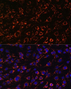 Invitrogen TOMM20 Polyclonal Antibody 100 &mu;L; Unconjugated:Antibodies,