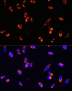 Invitrogen TOMM20 Polyclonal Antibody 100 &mu;L; Unconjugated:Antibodies,