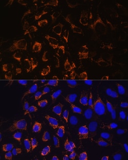 Invitrogen TOMM20 Polyclonal Antibody 100 &mu;L; Unconjugated:Antibodies,