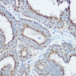 Invitrogen TOMM20 Polyclonal Antibody 100 &mu;L; Unconjugated:Antibodies,