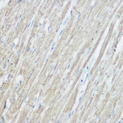 Invitrogen TOMM20 Polyclonal Antibody 100 &mu;L; Unconjugated:Antibodies,