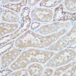 Invitrogen TOMM20 Polyclonal Antibody 100 &mu;L; Unconjugated:Antibodies,