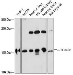 Invitrogen TOMM20 Polyclonal Antibody 100 &mu;L; Unconjugated:Antibodies,