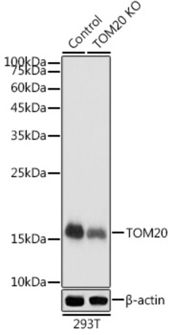 Invitrogen TOMM20 Polyclonal Antibody 100 &mu;L; Unconjugated:Antibodies,