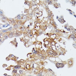 Invitrogen MEKK4 Polyclonal Antibody 100 &mu;L; Unconjugated:Antibodies,