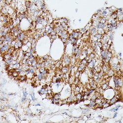 Invitrogen MEKK4 Polyclonal Antibody 100 &mu;L; Unconjugated:Antibodies,