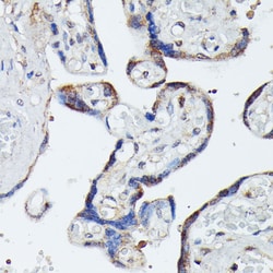Invitrogen MEKK4 Polyclonal Antibody 100 &mu;L; Unconjugated:Antibodies,