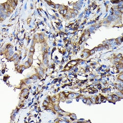 Invitrogen MYH9 Polyclonal Antibody 100 &mu;L; Unconjugated:Antibodies,