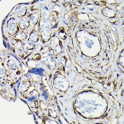 Invitrogen MYH9 Polyclonal Antibody 100 &mu;L; Unconjugated:Antibodies,