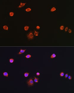 Invitrogen NPR3 Polyclonal Antibody 100 &mu;L; Unconjugated:Antibodies,